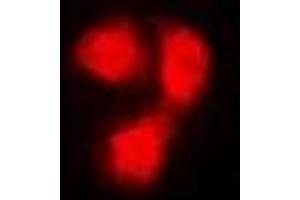 Immunofluorescent analysis of Beta 2 Microglobulin staining in Hela cells. (beta-2 Microglobulin Antikörper)
