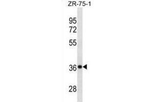 Western Blotting (WB) image for anti-Cysteine and Histidine-Rich Domain (CHORD)-Containing 1 (CHORDC1) antibody (ABIN3001211) (CHORDC1 Antikörper)