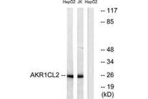 Western blot analysis of extracts from HepG2/Jurkat cells, using AKR1CL2 Antibody. (AKR1E2 Antikörper  (AA 141-190))