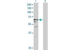 Western Blotting (WB) image for USP2 293T Cell Transient Overexpression Lysate(Denatured) (ABIN1334398)