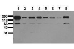 Western Blotting (WB) image for anti-Epidermal Growth Factor Receptor (EGFR) (C-Term) antibody (ABIN126786) (EGFR Antikörper  (C-Term))