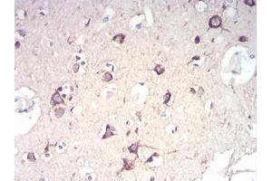 Immunohistochemistry (IHC) image for anti-Nuclear Factor of kappa Light Polypeptide Gene Enhancer in B-Cells Inhibitor, alpha (NFKBIA) (AA 150-291) antibody (ABIN5928181) (NFKBIA Antikörper  (AA 150-291))