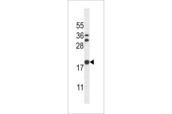 Stathmin 3 Antikörper  (C-Term)