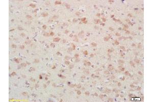 Formalin-fixed and paraffin embedded rat brain tissue labeled Anti-PSAP/PAP Polyclonal Antibody, Unconjugated (ABIN735773) at 1:200, followed by conjugation to the secondary antibody and DAB staining (Prosaposin Antikörper  (AA 101-200))