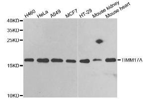 Western blot analysis of extracts of various cell lines, using TIMM17A antibody. (TIMM17A Antikörper  (AA 1-171))