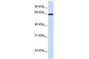 LCP1 antibody used at 1 ug/ml to detect target protein. (LCP1 Antikörper)