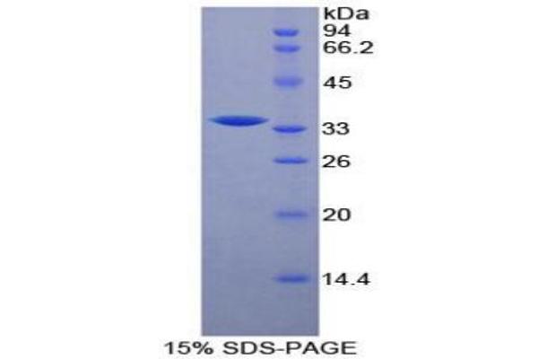 RFTN1 Protein