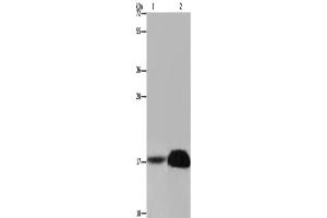 Western Blotting (WB) image for anti-Fragile Histidine Triad (FHIT) antibody (ABIN2423468) (FHIT Antikörper)