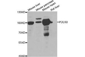 Western blot analysis of extracts of various cell lines, using PDE6B antibody (ABIN5975450) at 1/1000 dilution. (PDE6B Antikörper)