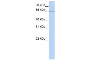 Western Blotting (WB) image for anti-Pumilio RNA Binding Family Member 3 (PUM3) antibody (ABIN2458487) (KIAA0020 Antikörper)