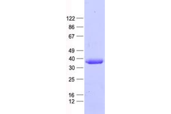 PPP4C Protein (His tag)