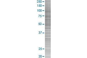 Western Blotting (WB) image for IFITM1 293T Cell Transient Overexpression Lysate(Denatured) (ABIN1334128)