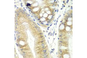 Immunohistochemistry of paraffin-embedded human colon using CES2 antibody (ABIN5970708) at dilution of 1/100 (40x lens). (CES2 Antikörper)