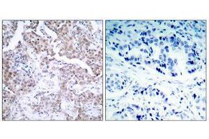 Immunohistochemistry (IHC) image for anti-Tumor Protein P53 (TP53) (pSer15) antibody (ABIN1847519) (p53 Antikörper  (pSer15))