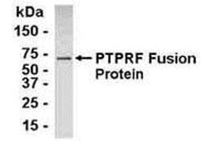 Western Blotting (WB) image for anti-Protein Tyrosine Phosphatase Receptor Type F (PTPRF) (AA 1151-1225) antibody (ABIN2467995) (PTPRF Antikörper  (AA 1151-1225))