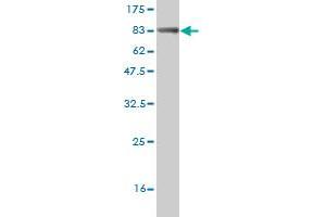 Western Blotting (WB) image for anti-Phosphoinositide 3 Kinase, p85 alpha (PI3K p85a) (AA 1-454) antibody (ABIN518903)