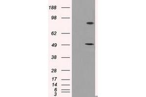 HEK293T cells were transfected with the pCMV6-ENTRY control (Left lane) or pCMV6-ENTRY PSMC3 (Right lane) cDNA for 48 hrs and lysed. (PSMC3 Antikörper)