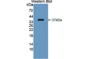 Figure. (SRPK3 Antikörper  (AA 247-517))