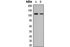 Western blot analysis of DAXX expression in HeLa (A), A549 (B) whole cell lysates. (DAXX Antikörper  (C-Term))