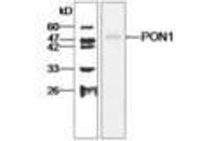 Image no. 1 for anti-Paraoxonase 1 (PON1) antibody (ABIN791456) (PON1 Antikörper)
