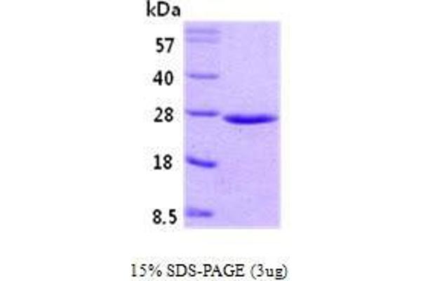 RAB5 Protein (AA 1-215)