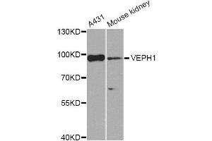 Western blot analysis of extracts of various cell lines, using VEPH1 Antibody (ABIN5974616) at 1/1000 dilution. (VEPH1 Antikörper)