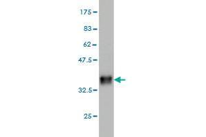 Western Blotting (WB) image for anti-Cystinosis, Nephropathic (CTNS) (AA 1-100) antibody (ABIN560527)