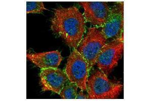 Immunofluorescence (IF) image for anti-Catenin (Cadherin-Associated Protein), beta 1, 88kDa (CTNNB1) (N-Term) antibody (ABIN2855042)