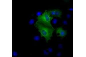 Image no. 2 for anti-Proteasome (Prosome, Macropain) 26S Subunit, ATPase, 3 (PSMC3) antibody (ABIN1501329) (PSMC3 Antikörper)