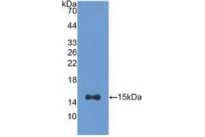 Detection of Recombinant ACO1, Human using Polyclonal Antibody to Aconitase 1 (ACO1) (Aconitase 1 Antikörper  (AA 458-586))