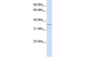 ALDOC antibody used at 1 ug/ml to detect target protein. (ALDOC Antikörper  (C-Term))