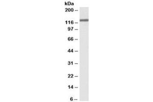 Western blot testing of HeLa lysate with OSMR antibody at 0. (Oncostatin M Receptor Antikörper)