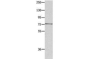 Western Blot analysis of Mouse eye tissue using MUC20 Polyclonal Antibody at dilution of 1:1400 (MUC20 Antikörper)