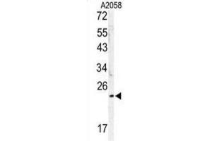 Western Blotting (WB) image for anti-MOB1, Mps One Binder Kinase Activator-Like 1B (MOBKL1B) antibody (ABIN3003175) (MOB1A Antikörper)