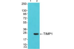 Western blot analysis of extracts from cos-7 cells (Lane 2), using TIMP1 Antibody. (TIMP1 Antikörper  (Internal Region))