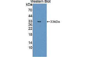 Detection of Recombinant ErbB3, Human using Polyclonal Antibody to V-Erb B2 Erythroblastic Leukemia Viral Oncogene Homolog 3 (ErbB3) (ERBB3 Antikörper  (AA 709-966))