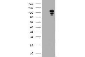 Image no. 1 for anti-Progesterone Receptor (PGR) antibody (ABIN1500186) (Progesterone Receptor Antikörper)