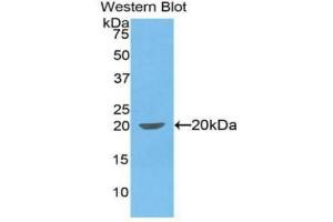 Detection of Recombinant IL1b, Canine using Polyclonal Antibody to Interleukin 1 Beta (IL1b) (IL-1 beta Antikörper  (AA 103-260))