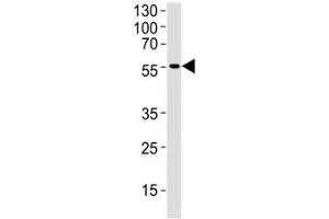 Western blot analysis of human brain tissue lysate using DCX antibody at 1:1000. (Doublecortin Antikörper  (AA 107-137))