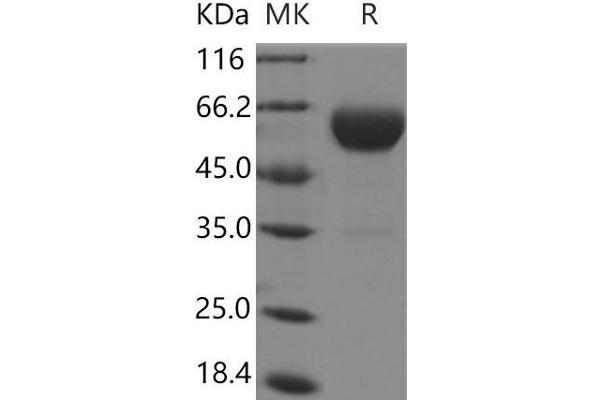 CPB2 Protein (His tag)