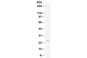 Western blot testing of human HeLa lysate with FGF19 antibody at 0. (FGF19 Antikörper)