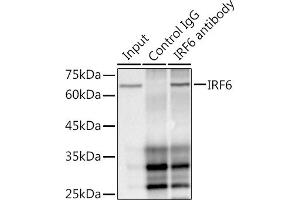 Immunoprecipitation analysis of 300 μg extracts of HepG2 cells using 3 μg IRF6 antibody (ABIN1680921, ABIN3017588, ABIN3017589 and ABIN7101507). (IRF6 Antikörper)