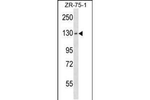 Western blot analysis in ZR-75-1 cell line lysates (35ug/lane). (HKDC1 Antikörper  (C-Term))
