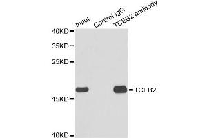 Immunoprecipitation analysis of 150 μg extracts of MCF7 cells using 3 μg TCEB2 antibody (ABIN5973098). (TCEB2 Antikörper)