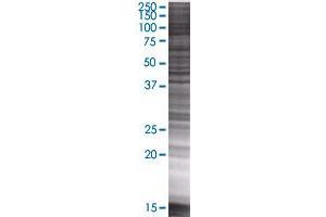 RP2 transfected lysate. (RP2 293T Cell Transient Overexpression Lysate(Denatured))