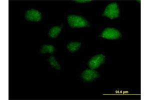 Immunofluorescence of purified MaxPab antibody to ZBTB32 on HeLa cell. (ZBTB32 Antikörper  (AA 1-302))