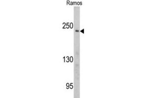 Western Blotting (WB) image for anti-Pericentriolar Material 1 (PCM1) antibody (ABIN3003242) (PCM1 Antikörper)