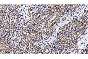 Detection of LY96 in Mouse Kidney Tissue using Polyclonal Antibody to Lymphocyte Antigen 96 (LY96) (LY96 Antikörper  (AA 19-130))