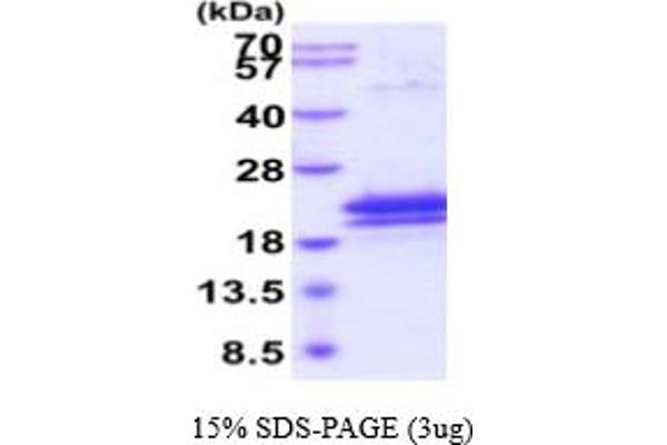 IL17B Protein (AA 21-180) (His tag)