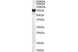 Western Blotting (WB) image for anti-Frizzled Family Receptor 8 (FZD8) (C-Term) antibody (ABIN2465732) (FZD8 Antikörper  (C-Term))